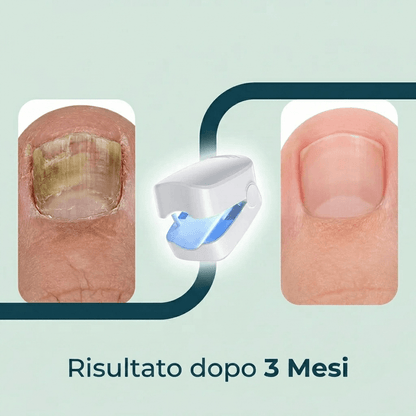 Nailvera | Trattamento per unghie pulite e sane
